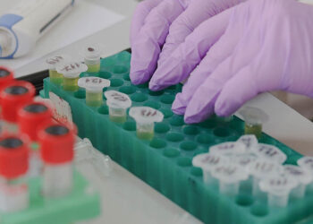 Συνεργασία  Βορίδη – Κικίλια για τη διασφάλιση της Δημόσιας Υγείας