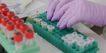 Συνεργασία  Βορίδη – Κικίλια για τη διασφάλιση της Δημόσιας Υγείας